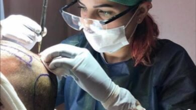 زراعة الشعر بدون حلاقة حصرياً في مركز Estepera