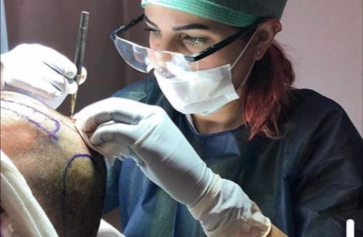 زراعة الشعر بدون حلاقة حصرياً في مركز Estepera