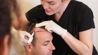 مركز Estepera واحدث تقنيات زراعة الشعر العالمية