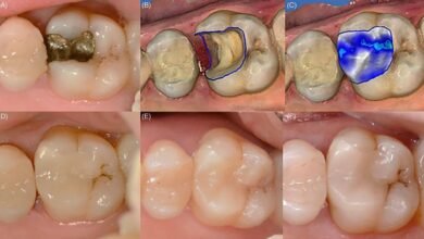 بين الماضي والحاضر… الدكتور حبيب ظريفه يوضح عن آلية استخدام تقنية “CAD/CAM Technology” في طب الأسنان