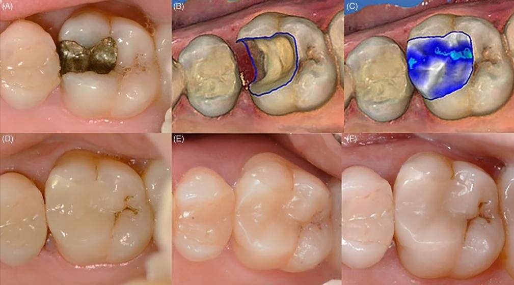 بين الماضي والحاضر… الدكتور حبيب ظريفه يوضح عن آلية استخدام تقنية “CAD/CAM Technology” في طب الأسنان