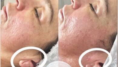 العيادة الطبية التجميلية “The Carnaby Laser Clinic” تُكَرَّم من قِبل “IMAGE SKINCARE” لمرات متتالية