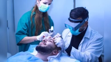 Tito center… نتائج مبهرة على مستوى زراعة الشعر
