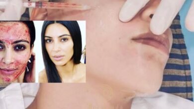 ‏ Dermand Clinic تقدم تقنية الـ”PRP” بجودة عالية واهتمامٍ لا مثيل له