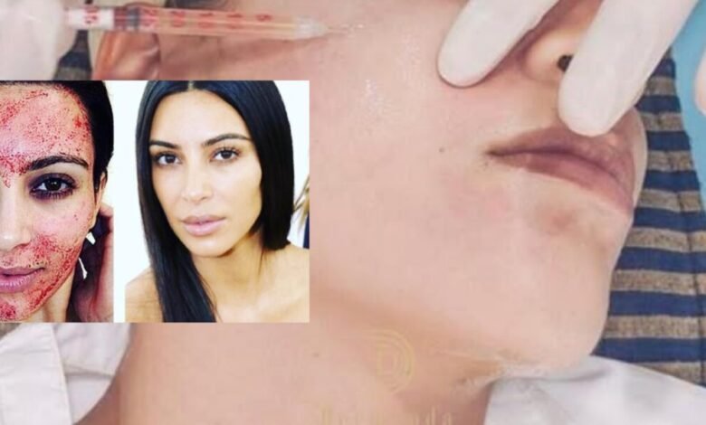 ‏ Dermand Clinic تقدم تقنية الـ”PRP” بجودة عالية واهتمامٍ لا مثيل له