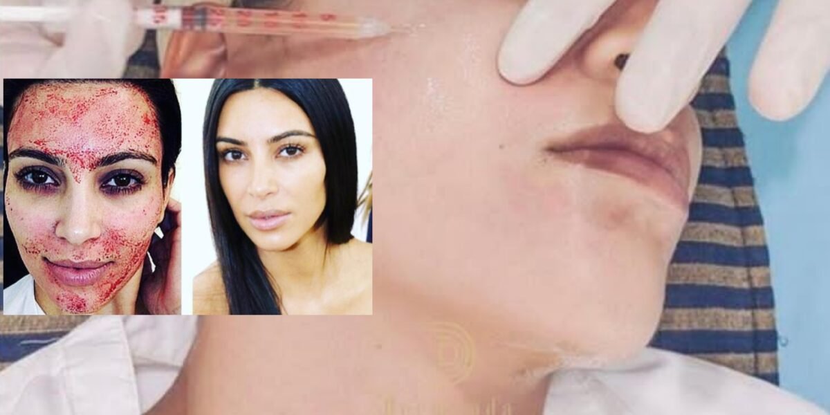 ‏ Dermand Clinic تقدم تقنية الـ”PRP” بجودة عالية واهتمامٍ لا مثيل له